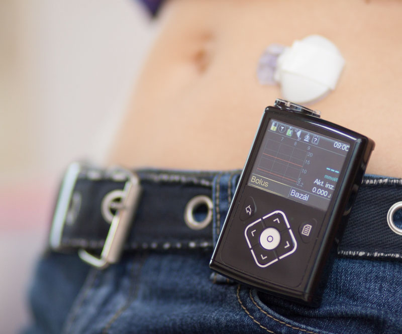 měřicí zařízení